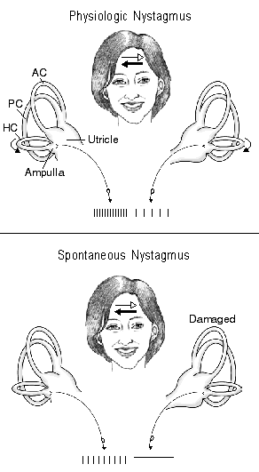 Illustration C